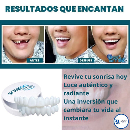CARILLAS DENTALES SNAP ON DENTURE UN CAMBIO QUE TRANSFORMA TU VIDA AL INSTANTE