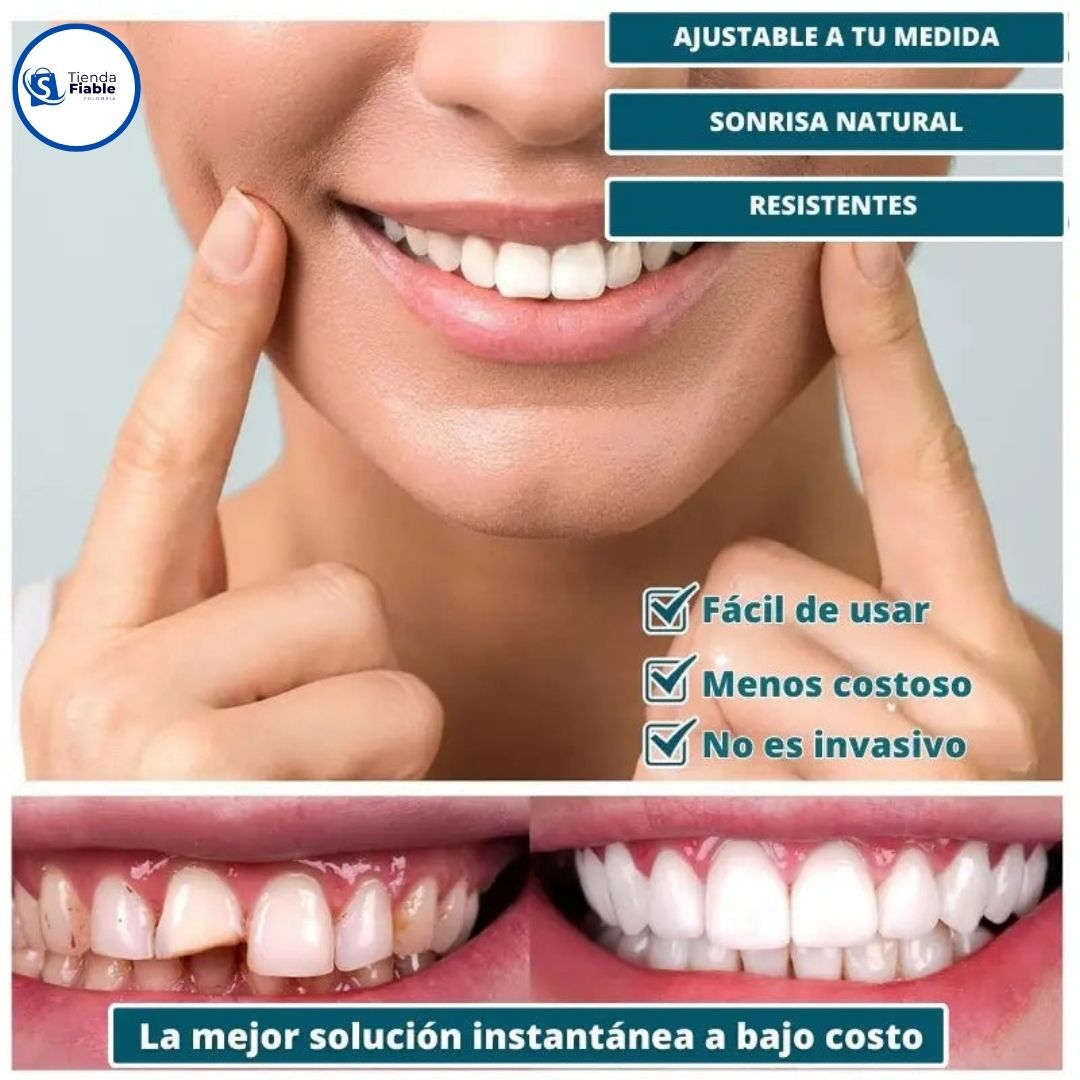 CARILLAS DENTALES SNAP ON DENTURE UN CAMBIO QUE TRANSFORMA TU VIDA AL INSTANTE
